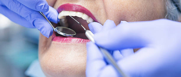 Best Emergency Treatment for Dental Infections or Abscesses in Romoland, CA